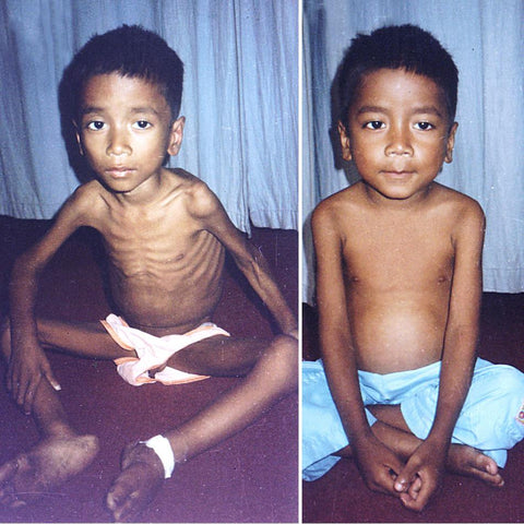 Give a gift that matters: a donation in your friend's name. This gift will enable one severely emaciated child to stay at one of NYOF’s Nutritional Rehabilitati